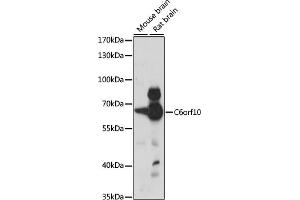 Western blot analysis of extracts of various cell lines, using C6orf10 antibody (ABIN7266238) at 1:1000 dilution. (CDNA Sequence BC051142 (BC051142) (AA 220-470) anticorps)