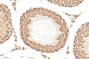 Immunohistochemistry analysis of paraffin-embedded mouse testis using,MCM4 (ABIN7074631) at dilution of 1: 2400 (MCM4 anticorps)