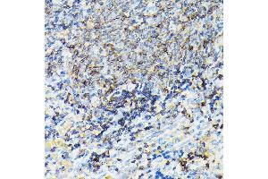 Immunohistochemistry of paraffin-embedded rat spleen using CORO1A Rabbit pAb (ABIN6133495, ABIN6138903, ABIN6138904 and ABIN6224969) at dilution of 1:100 (40x lens). (Coronin 1a anticorps  (AA 362-461))