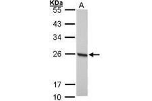 Image no. 1 for anti-Peroxiredoxin 1 (PRDX1) (AA 19-116) antibody (ABIN467365) (Peroxiredoxin 1 anticorps  (AA 19-116))