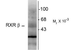 Western blots of hippocampal lysate showing specific immunolabeling of the ~48k RXR-ß protein.