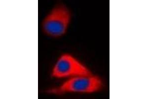Immunofluorescent analysis of MVK staining in HepG2 cells. (MVK anticorps)
