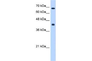 WB Suggested Anti-CHST8 Antibody Titration:  0. (CHST8 anticorps  (Middle Region))
