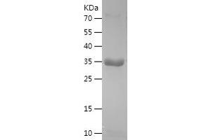 Western Blotting (WB) image for Inhibin, beta A (INHBA) (AA 311-426) protein (His-IF2DI Tag) (ABIN7123423) (INHBA Protein (AA 311-426) (His-IF2DI Tag))