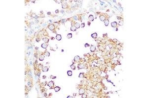 Immunohistochemistry of paraffin-embedded rat testis using Smac/Diablo Rabbit pAb (ABIN3023378, ABIN3023379, ABIN3023380 and ABIN6219667) at dilution of 1:100 (40x lens). (DIABLO anticorps  (AA 1-232))