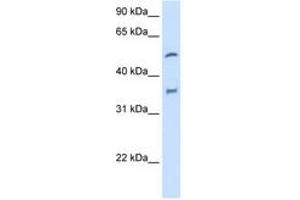 Image no. 2 for anti-Cytochrome P450, Family 2, Subfamily D, Polypeptide 6 (CYP2D6) (AA 101-150) antibody (ABIN204973) (CYP2D6 anticorps  (AA 101-150))