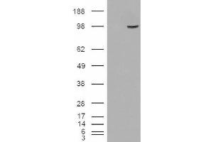 Image no. 2 for anti-Serine/threonine-Protein Phosphatase 4 Regulatory Subunit 3A (SMEK1) (Internal Region) antibody (ABIN375112) (SMEK1 anticorps  (Internal Region))
