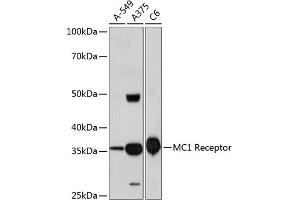 Western blot analysis of extracts of various cell lines, using MC1 Receptor Rabbit mAb  at 1:1000 dilution.