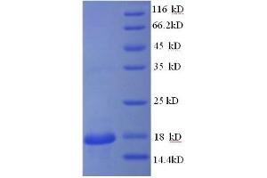 SDS-PAGE (SDS) image for Hemoglobin, beta Adult Minor Chain (HBB-B2) (AA 2-147) protein (GST tag) (ABIN5711059)