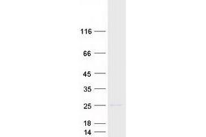 Validation with Western Blot