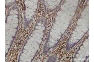 Immunoperoxidase of monoclonal antibody to SHMT1 on formalin-fixed paraffin-embedded human colon tissue.