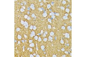 Immunohistochemistry of paraffin-embedded rat brain using GRIK2 Rabbit mAb (ABIN7267415) at dilution of 1:100 (40x lens).