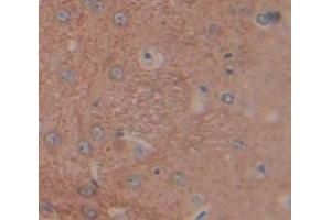 Used in DAB staining on fromalin fixed paraffin- embedded Kidney tissue (LCNL1 anticorps  (AA 2-164))