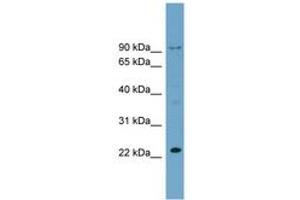 RSL24D1 antibody  (C-Term)
