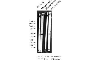 Western blot analysis of Phospho-p38 MAPK (Tyr182) expression in various lysates (MAPK14 anticorps  (pTyr182))