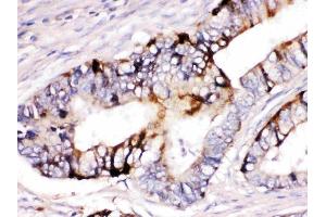 IHC analysis of ZP2 using anti-ZP2 antibody (ABIN3044563).
