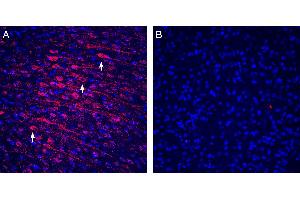 Expression of Tetraspanin-3 in rat cortex. (Tetraspanin 3 anticorps  (Extracellular))