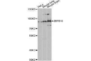 Western blot analysis of extracts of various cell lines, using ZBTB16 Antibody (ABIN5973474) at 1/1000 dilution. (ZBTB16 anticorps)