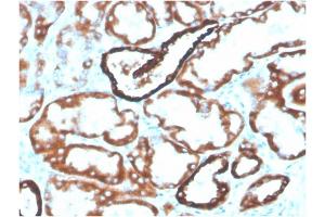 Formalin-fixed, paraffin-embedded human kidney stained with Biotin-conjugated CDH16Mouse Monoclonal Antibody (CDH16/2125). (Cadherin-16 anticorps  (AA 371-507) (Biotin))