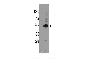 Western blot analysis of NROB1 (arrow) using rabbit polyclonal NROB1 Antibody (Human C-term) (ABIN389158 and ABIN2839324). (NR0B1 anticorps  (C-Term))