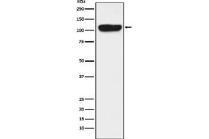 Western blot analysis of ITCH expression in K562 cell lysate.