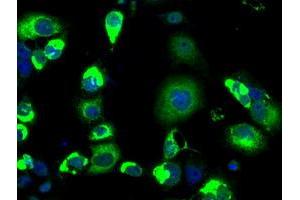 Image no. 3 for anti-Lysyl Oxidase (LOX) (AA 22-168) antibody (ABIN1491218)