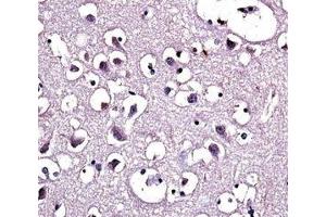 LPL antibody immunohistochemistry analysis in formalin fixed and paraffin embedded human brain tissue. (Lipoprotein Lipase anticorps  (AA 300-327))