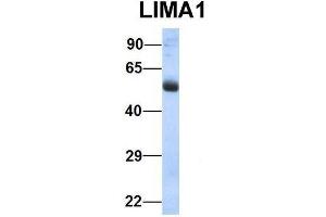 Host:  Rabbit  Target Name:  LIMA1  Sample Type:  Human Fetal Lung  Antibody Dilution:  1. (LIMA1 anticorps  (N-Term))