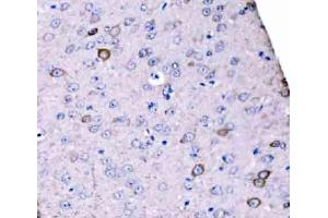 IHC analysis of SCRN1 using anti-SCRN1 antibody (ABIN7602923). (Secernin 1 anticorps  (C-Term))