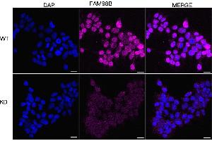 Immunocytochemical staining of HeLa cells using FAM98B antibody (ABIN7798562), 1:1,000), Top panel: wild-type (WT), Bottom panal: FAM98B shRNA knockdown (KD). (Recombinant FAM98B anticorps)