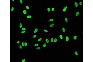 anti-Histone H3.1 (HIST1H3B) (H3K56ac) antibody