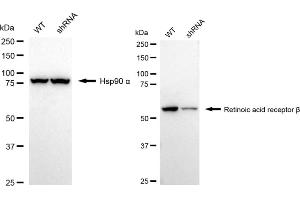 Western blotting analysis using Retinoic Acid Receptor beta antibody (ABIN7800190). (Recombinant Retinoic Acid Receptor beta anticorps)