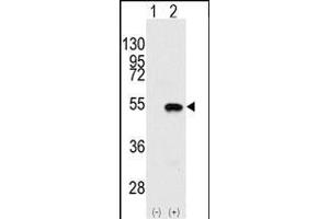 Western blot analysis of SYMD2 (arrow) using rabbit polyclonal SYMD2 Antibody (N-term) (ABIN387897 and ABIN2844146). (SMYD2A anticorps  (N-Term))