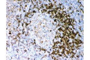 IHC analysis of CD79A using anti-CD79A antibody (ABIN3043397).