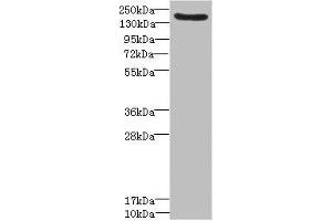 Western blot All lanes: LY75 antibody IgG at 1. (LY75/DEC-205 anticorps  (AA 440-680))
