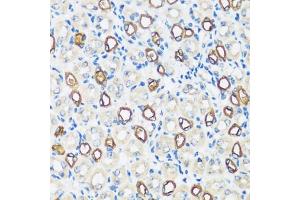 Immunohistochemistry of paraffin-embedded mouse kidney using  antibody (ABIN7265652) at dilution of 1:100 (40x lens).