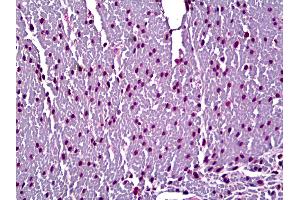 Anti-Myosin, Cardiac Heavy Chain antibody IHC of human heart.
