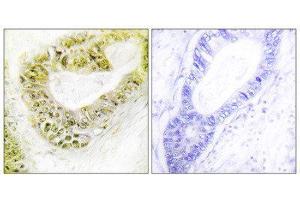 Immunohistochemistry (IHC) image for anti-Zinc Finger Protein 638 (ZNF638) (Internal Region) antibody (ABIN1849604) (ZNF638 anticorps  (Internal Region))