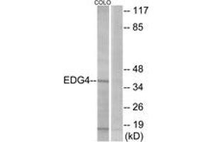 Western Blotting (WB) image for anti-Lysophosphatidic Acid Receptor 2 (LPAR2) (AA 290-339) antibody (ABIN2890765) (EDG4 anticorps  (AA 290-339))