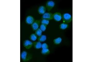 IF analysis of Neurofibromin/NF1 using anti-Neurofibromin/NF1 antibody (ABIN7600197). (Neurofibromin 1 anticorps  (AA 160-270))