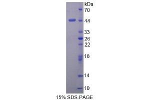 SDS-PAGE analysis of Human DHPS Protein. (DHPS Protéine)