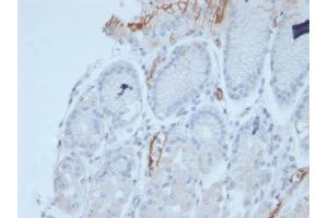 Formalin-fixed, paraffin-embedded human stomach stained with MUC2 Recombinant Mouse Monoclonal Antibody (rMLP/842).