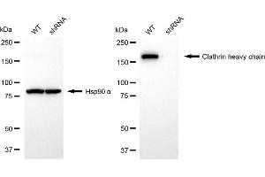 Western blotting analysis using clathrin heavy chain antibody (ABIN7798091). (Recombinant Clathrin Heavy Chain (CLTC) anticorps)