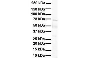 WB Suggested Anti-LBX1 antibody Titration: 1 ug/mL Sample Type: Human heart