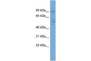 WB Suggested Anti-CDH4  Antibody Titration: 0. (Cadherin 4 anticorps  (Middle Region))