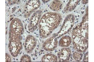 Image no. 3 for anti-Ras Homolog Gene Family, Member J (RHOJ) antibody (ABIN1501341)