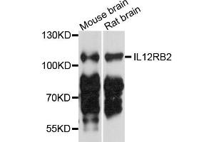 Western blot analysis of extract of MCF7 and HeLa cells, using IL12RB2 antibody.