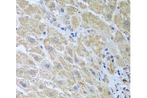 Immunohistochemistry of paraffin-embedded Human liver using WDR48 Polyclonal Antibody at dilution of 1:100 (40x lens). (WDR48 anticorps)
