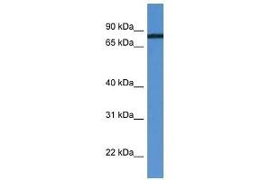 HHIPL1 antibody used at 0. (HHIPL1 anticorps  (C-Term))