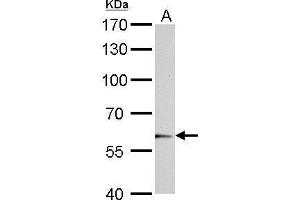 WB Image UGT1A6 antibody detects UGT1A6 protein by Western blot analysis.